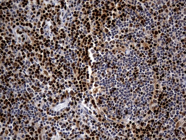 ALOX5 Antibody in Immunohistochemistry (Paraffin) (IHC (P))