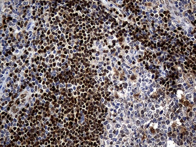 ALOX5 Antibody in Immunohistochemistry (Paraffin) (IHC (P))