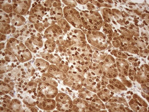 ALOX5 Antibody in Immunohistochemistry (Paraffin) (IHC (P))