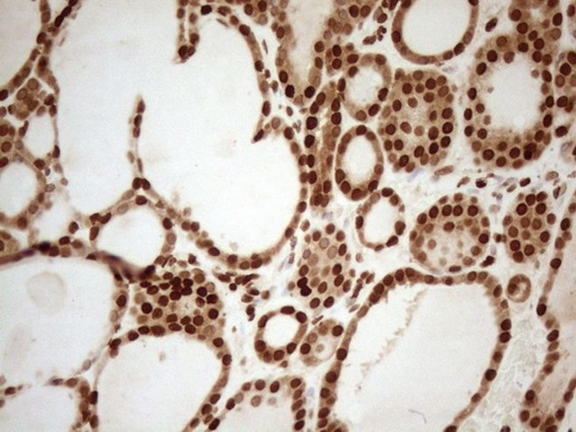 ALOX5 Antibody in Immunohistochemistry (Paraffin) (IHC (P))