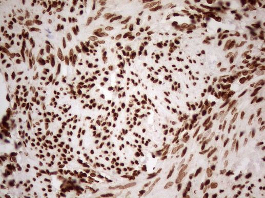 ALOX5 Antibody in Immunohistochemistry (Paraffin) (IHC (P))