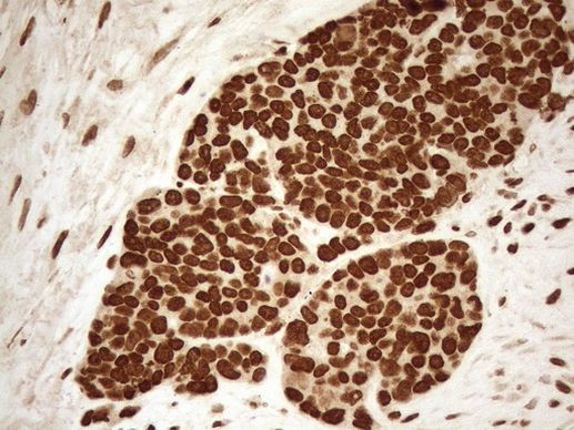 ALOX5 Antibody in Immunohistochemistry (Paraffin) (IHC (P))