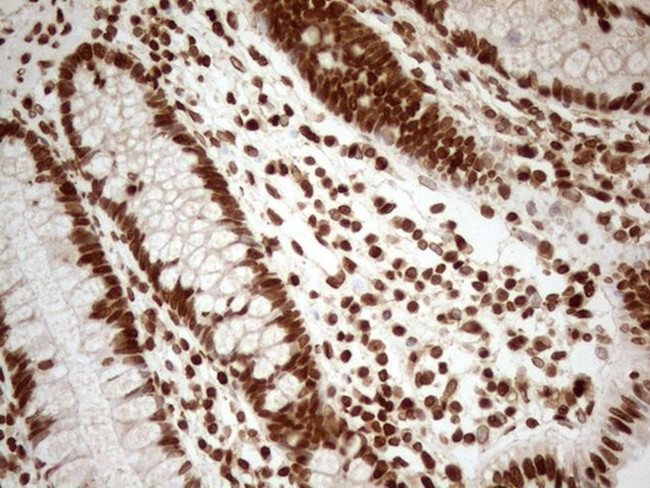 ALOX5 Antibody in Immunohistochemistry (Paraffin) (IHC (P))