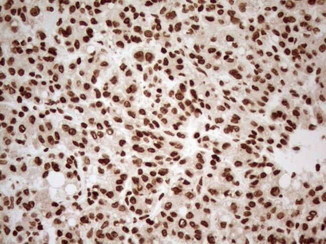 ALOX5 Antibody in Immunohistochemistry (Paraffin) (IHC (P))