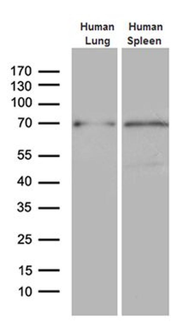 ALOX5 Antibody in Western Blot (WB)