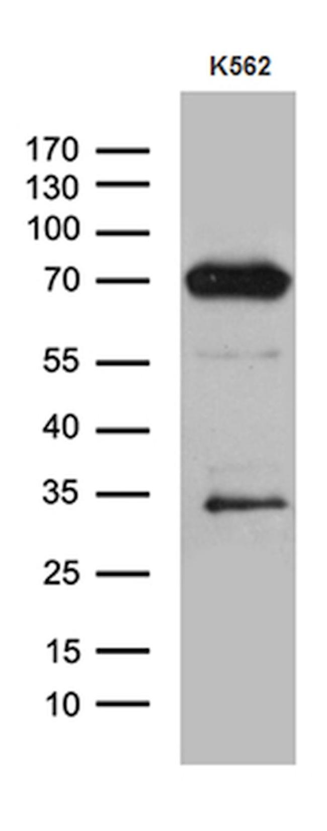 ALOX5 Antibody in Western Blot (WB)