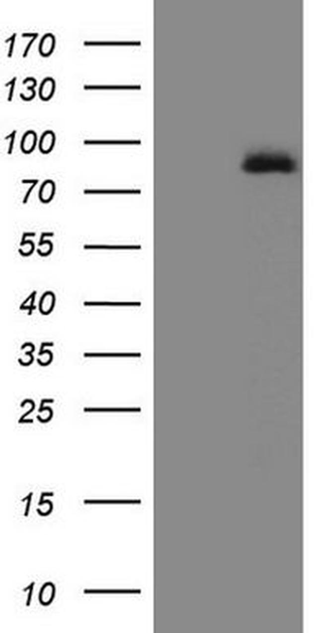 ALOX5 Antibody in Western Blot (WB)