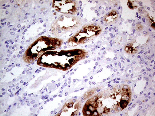 ALPI Antibody in Immunohistochemistry (Paraffin) (IHC (P))