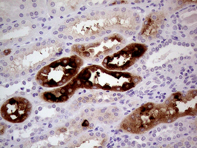 ALPI Antibody in Immunohistochemistry (Paraffin) (IHC (P))