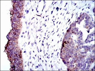 ALPL Antibody in Immunohistochemistry (Paraffin) (IHC (P))