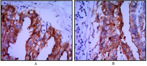 Placental Alkaline Phosphatase Antibody in Immunohistochemistry (Paraffin) (IHC (P))