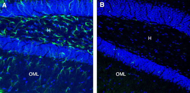 CLEC7A/Dectin-1 (extracellular) Antibody in Immunohistochemistry (Frozen) (IHC (F))