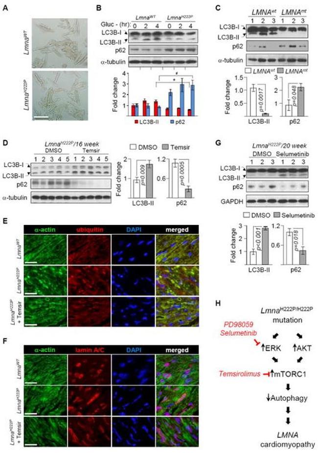 Sarcomeric alpha Actin Antibody in Immunocytochemistry (ICC/IF)