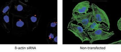 beta Actin Antibody in Immunocytochemistry (ICC/IF)