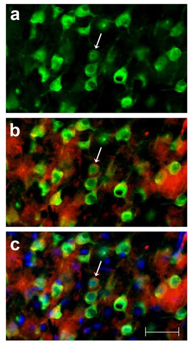 TNF alpha Antibody in Immunocytochemistry (ICC/IF)