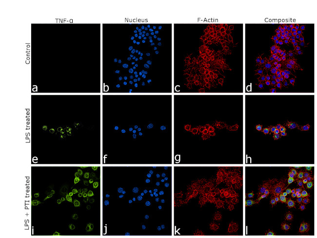 TNF alpha Antibody in Immunocytochemistry (ICC/IF)