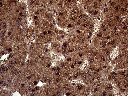 AMDHD1 Antibody in Immunohistochemistry (Paraffin) (IHC (P))