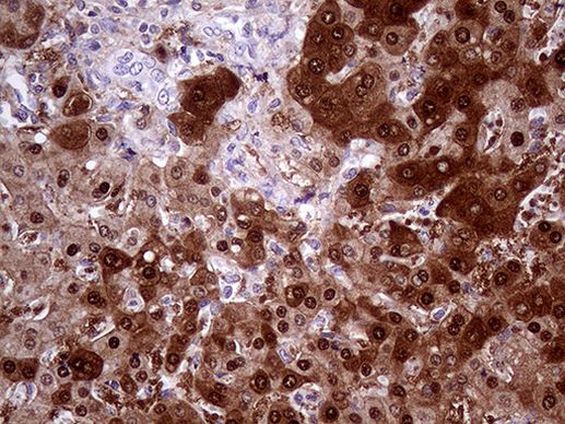 AMDHD1 Antibody in Immunohistochemistry (Paraffin) (IHC (P))