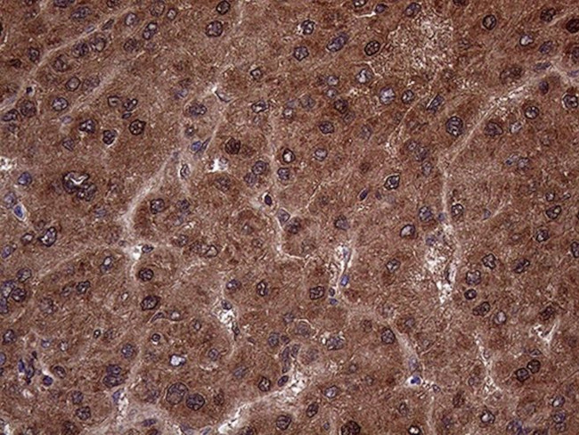 AMDHD1 Antibody in Immunohistochemistry (Paraffin) (IHC (P))