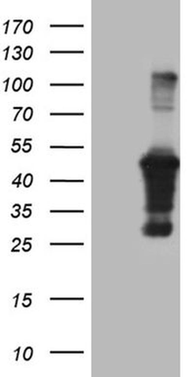 AMDHD1 Antibody in Western Blot (WB)