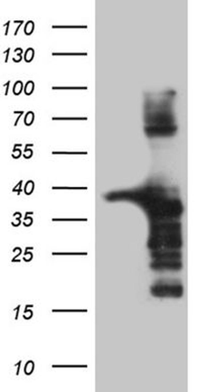 AMDHD1 Antibody in Western Blot (WB)