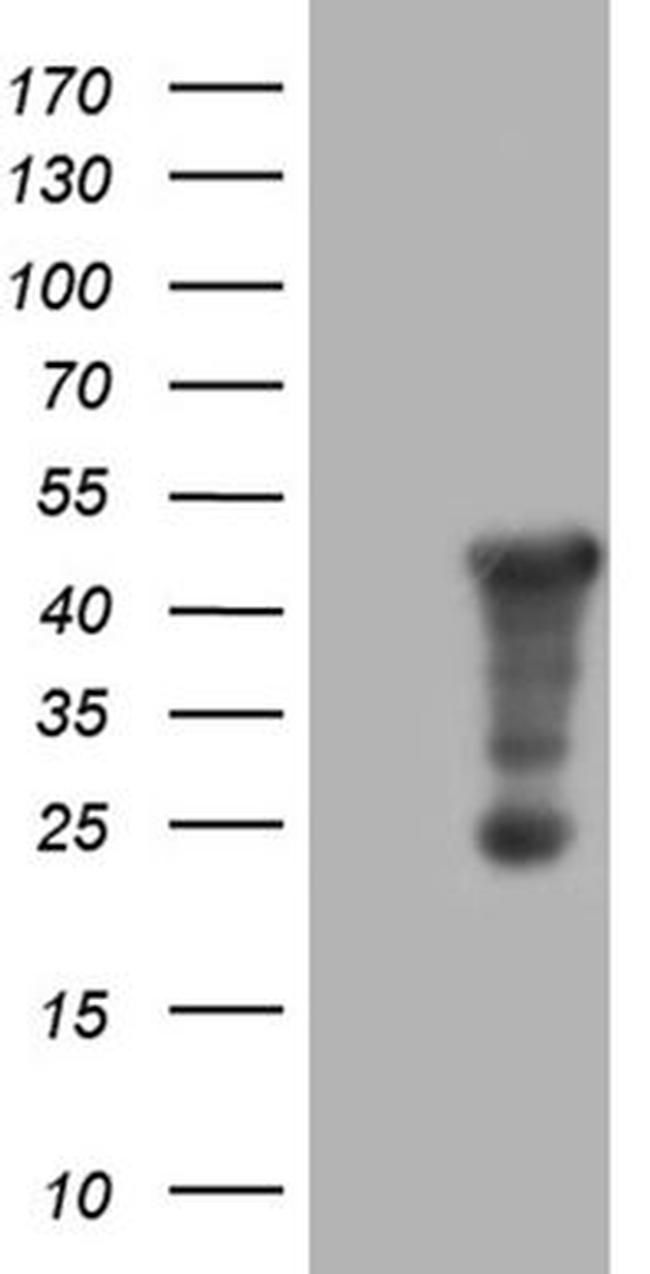 AMDHD1 Antibody in Western Blot (WB)