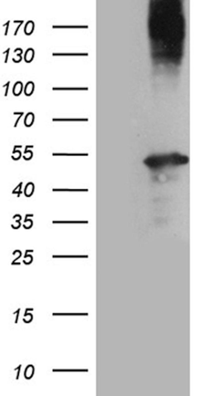 AMDHD1 Antibody in Western Blot (WB)