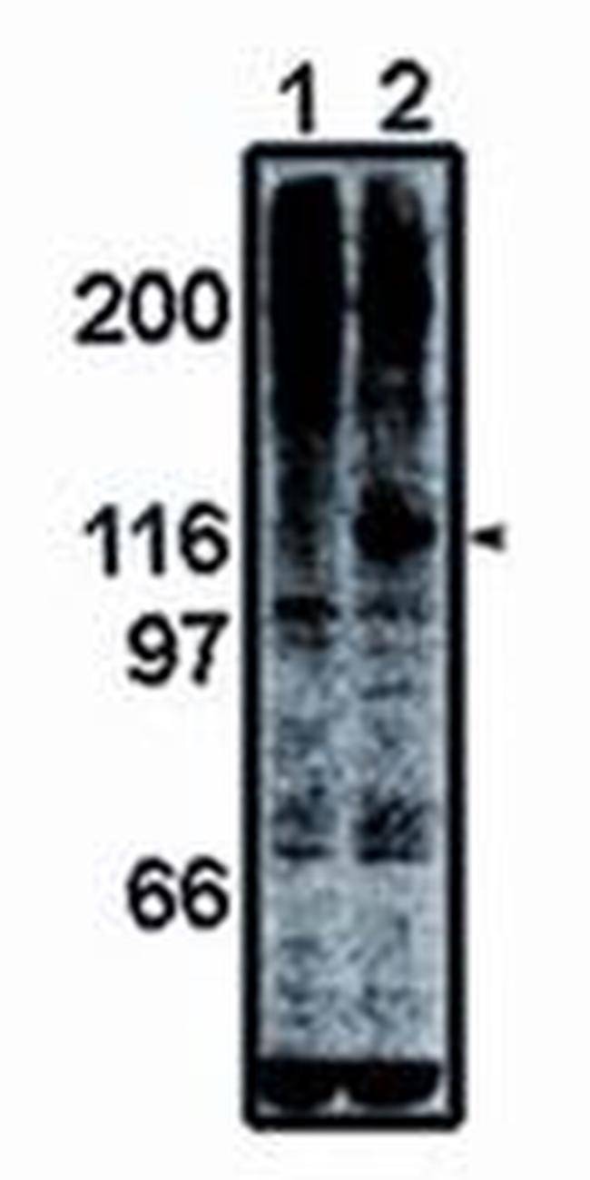 FAK Antibody in Western Blot (WB)