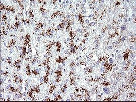 AMOT Antibody in Immunohistochemistry (Paraffin) (IHC (P))