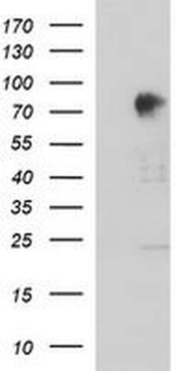 AMOT Antibody in Western Blot (WB)