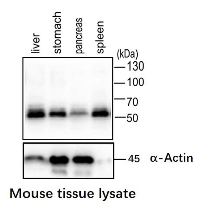 AMPK alpha-1 Antibody in Western Blot (WB)