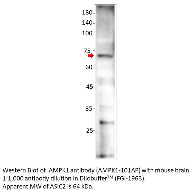 AMPK alpha 1 Antibody in Western Blot (WB)
