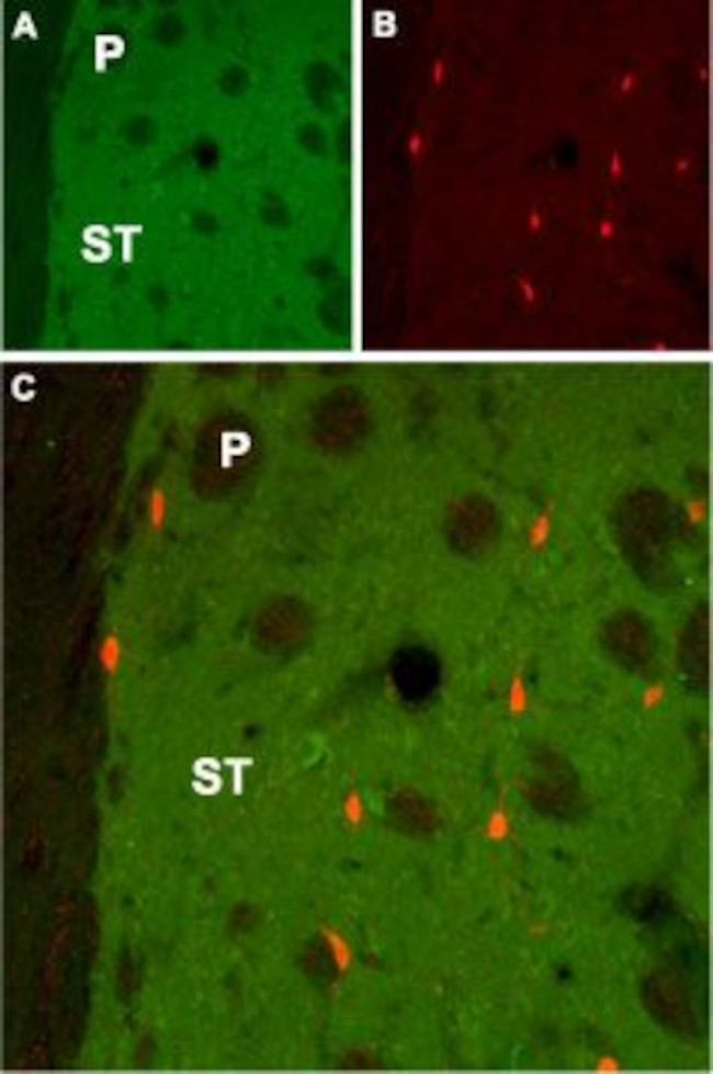 CHRM1 Antibody in Immunohistochemistry (IHC)