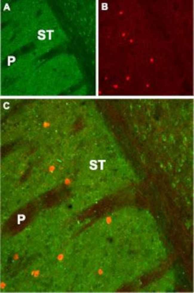 CHRM1 Antibody in Immunohistochemistry (IHC)