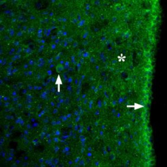 MC3 Receptor (extracellular) Antibody in Immunohistochemistry (Frozen) (IHC (F))