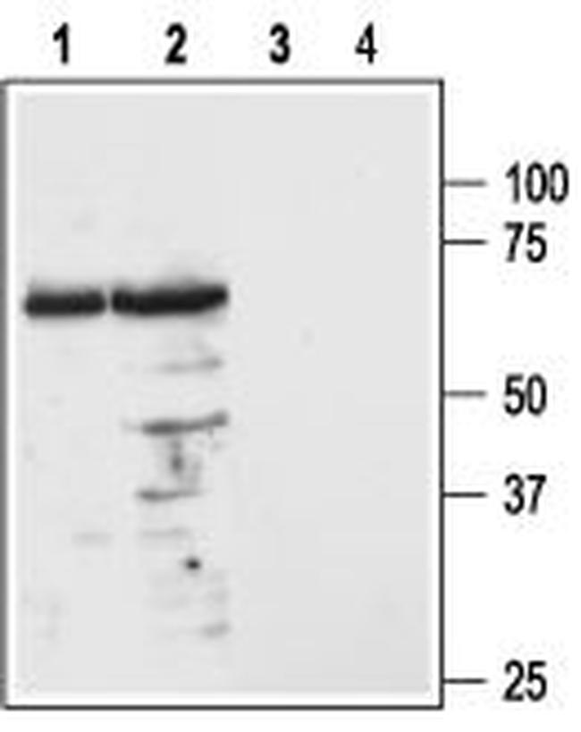 MC3 Receptor (extracellular) Antibody in Western Blot (WB)
