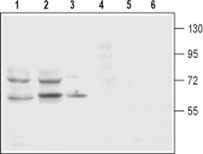 Dopamine Transporter (DAT) (extracellular) Antibody in Western Blot (WB)