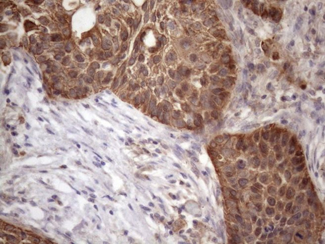 AMTN Antibody in Immunohistochemistry (Paraffin) (IHC (P))