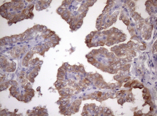 AMTN Antibody in Immunohistochemistry (Paraffin) (IHC (P))