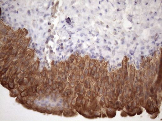 AMTN Antibody in Immunohistochemistry (Paraffin) (IHC (P))