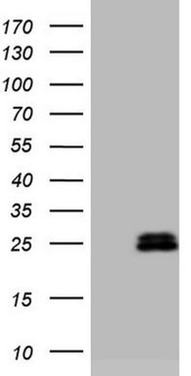 AMTN Antibody in Western Blot (WB)