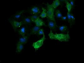 ANAPC11 Antibody in Immunocytochemistry (ICC/IF)