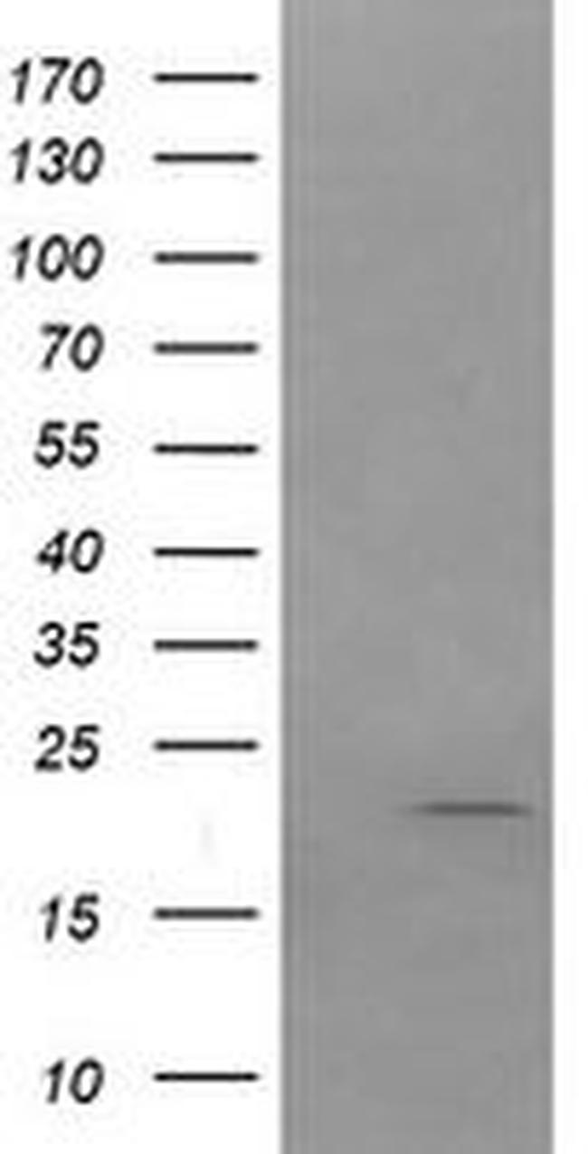 ANAPC11 Antibody in Western Blot (WB)