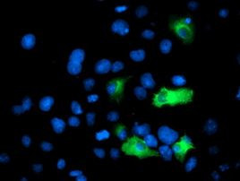 ANAPC2 Antibody in Immunocytochemistry (ICC/IF)