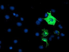 ANAPC2 Antibody in Immunocytochemistry (ICC/IF)