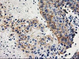 ANAPC2 Antibody in Immunohistochemistry (Paraffin) (IHC (P))