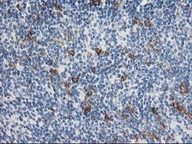 ANAPC2 Antibody in Immunohistochemistry (Paraffin) (IHC (P))