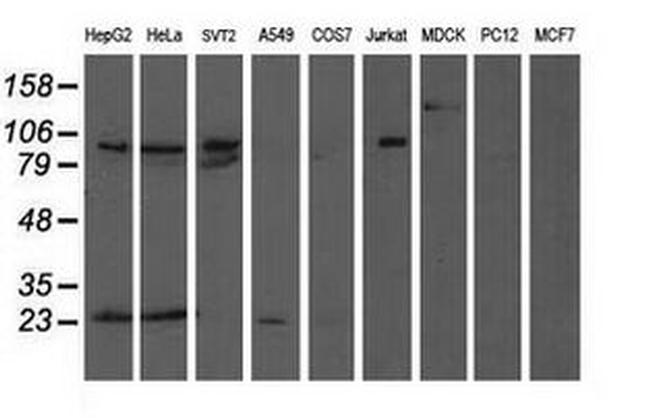 ANAPC2 Antibody in Western Blot (WB)