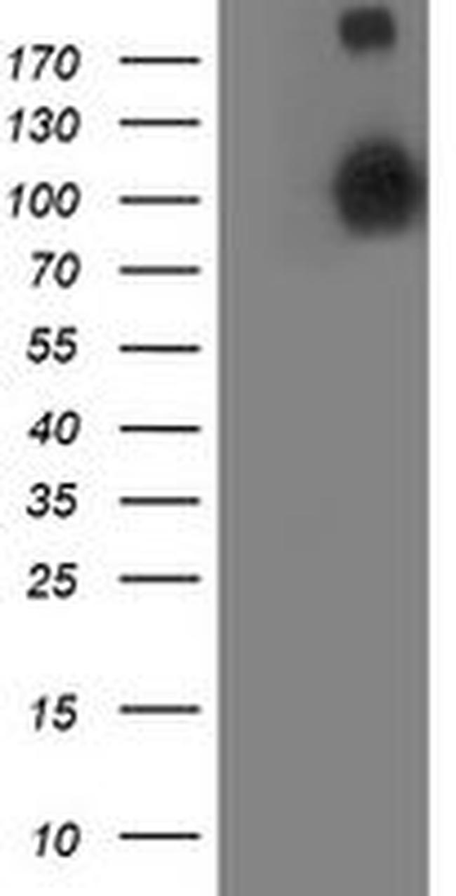 ANAPC2 Antibody in Western Blot (WB)