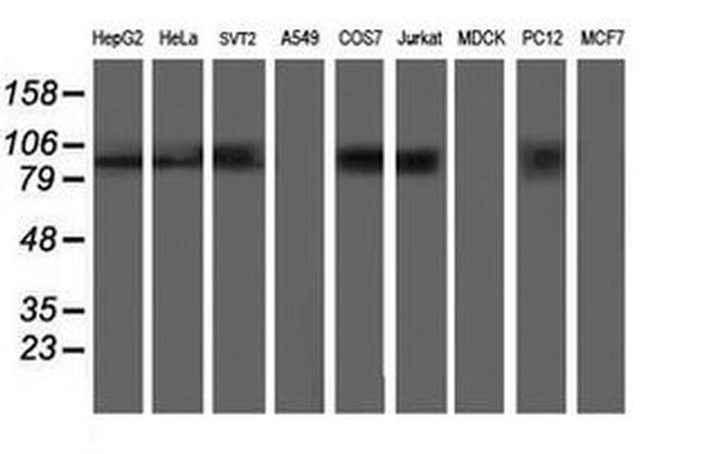 ANAPC2 Antibody in Western Blot (WB)